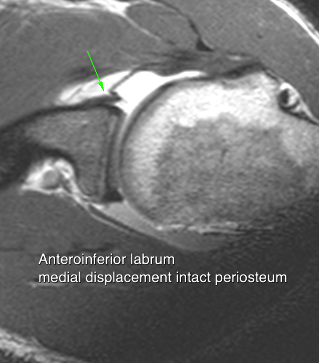 MSK RADIOLOGY